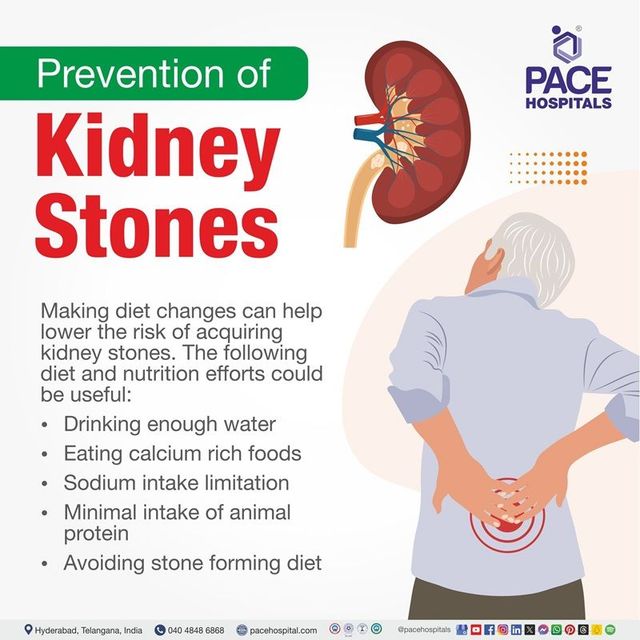 Kidney stone treatment at home sales